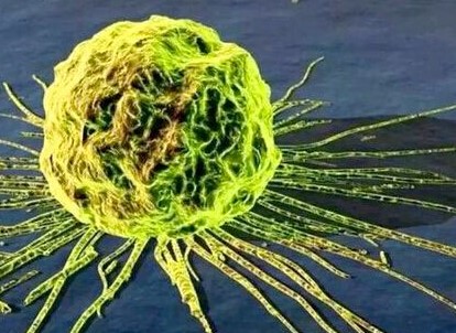 諾如病毒高發，預防很關鍵